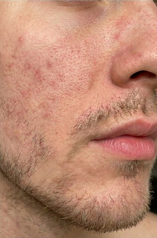 Ethan, 28