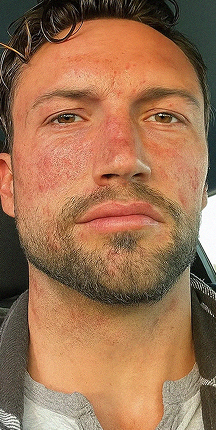 Jake, 34